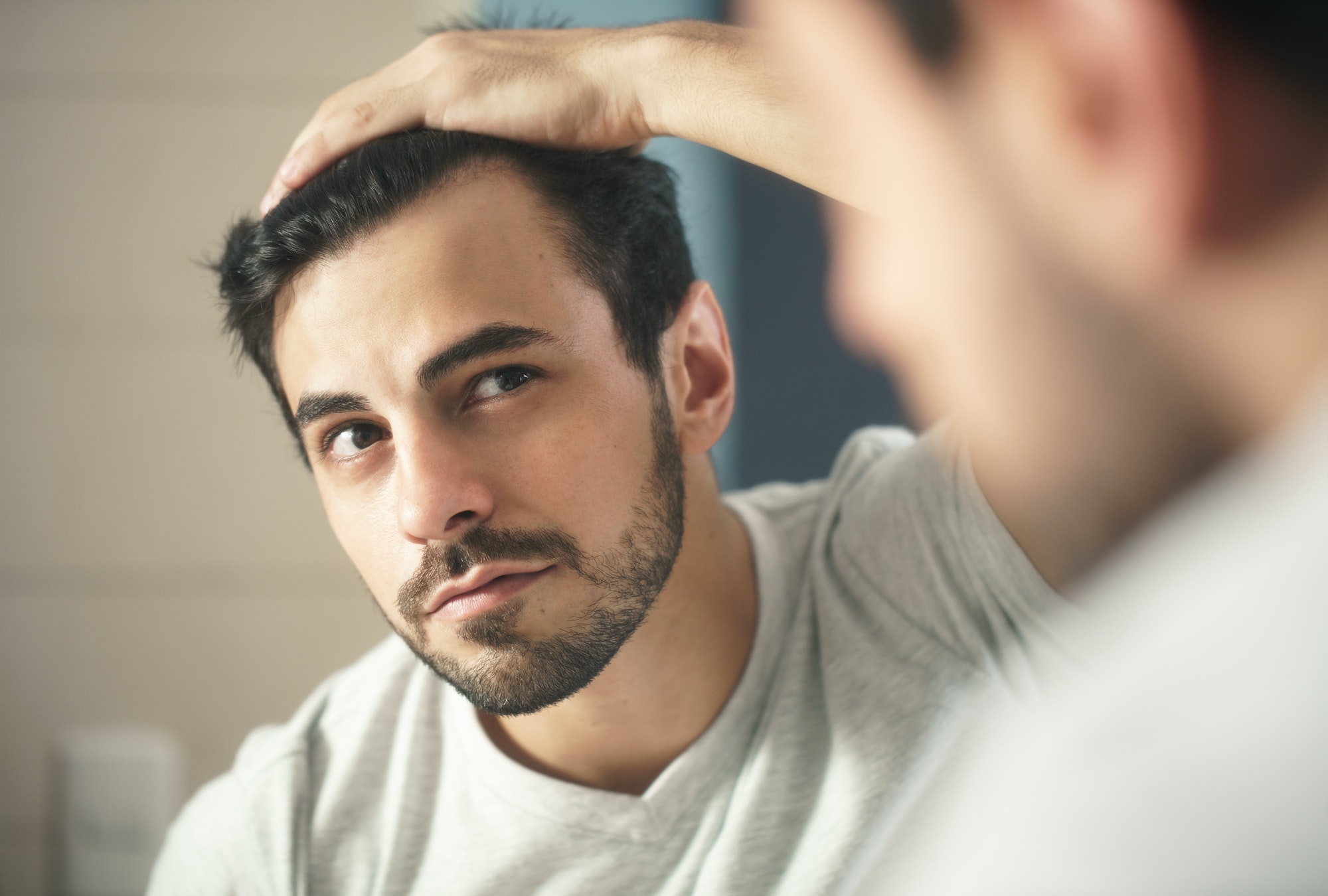 Man Worried For Alopecia Checking Hair For Loss